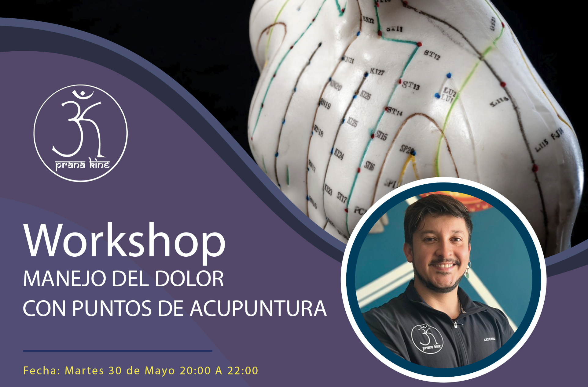 Workshop; Manejo del dolor con puntos de acupuntura